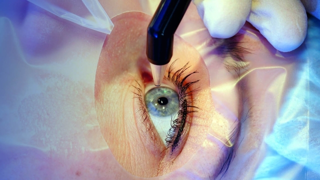 Seeing Clearly: Unveiling the Secrets of Ophthalmology